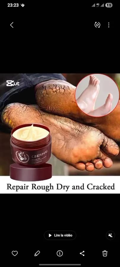 Syndinal crème