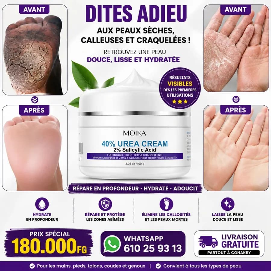 Crème pour les pieds 